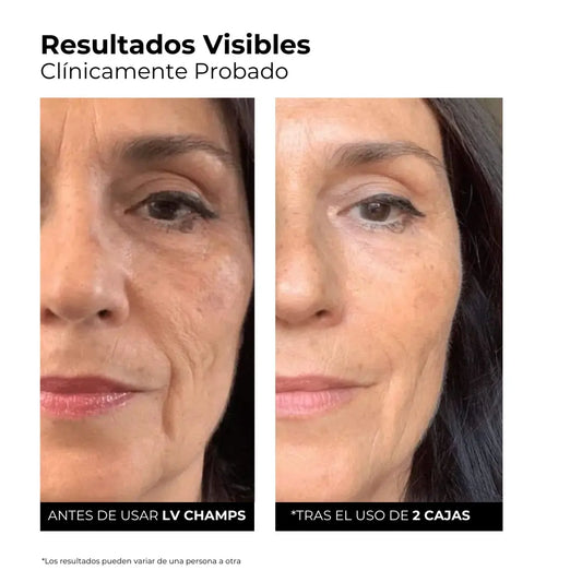 Serum Ultra Hidratante-Reparador con 3% de Ácido Hialurónico de LV Champs (30 Ampollas)