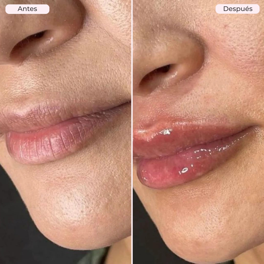 LV CHAMPS LIP PLUMPER