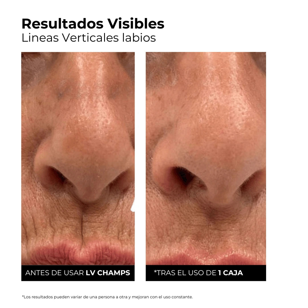 Sérum Hidro-Rellenador 3% Ácido Hialurónico + Péptidos