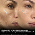 Cargar la imagen en la vista de la galería, Serum Anti-Vellos Encarnados, Manchas Oscuras/Rojizas y Granitos Con Triple Exfoliación
