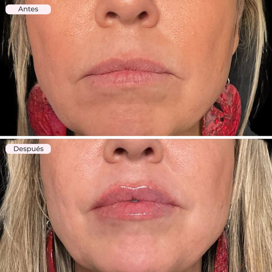 LV CHAMPS LIP PLUMPER
